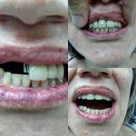 21911243_1770296543000482_4650908608962232320_n