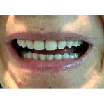 22427512_1684659438274169_4657073063853031424_n