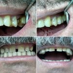 25015226_141299823165781_3852121065014689792_n