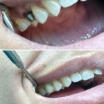 25036976_383651918743413_5096866436379312128_n