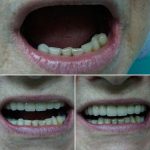 26223797_141020086581138_3415412501209153536_n